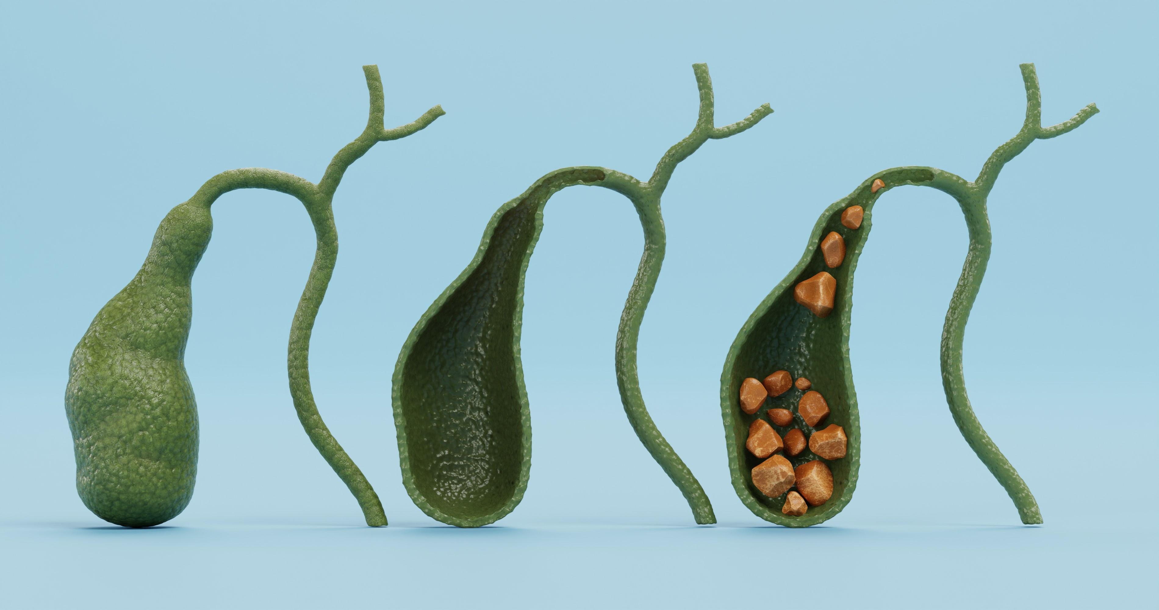 Pęcherzyk zółciowy