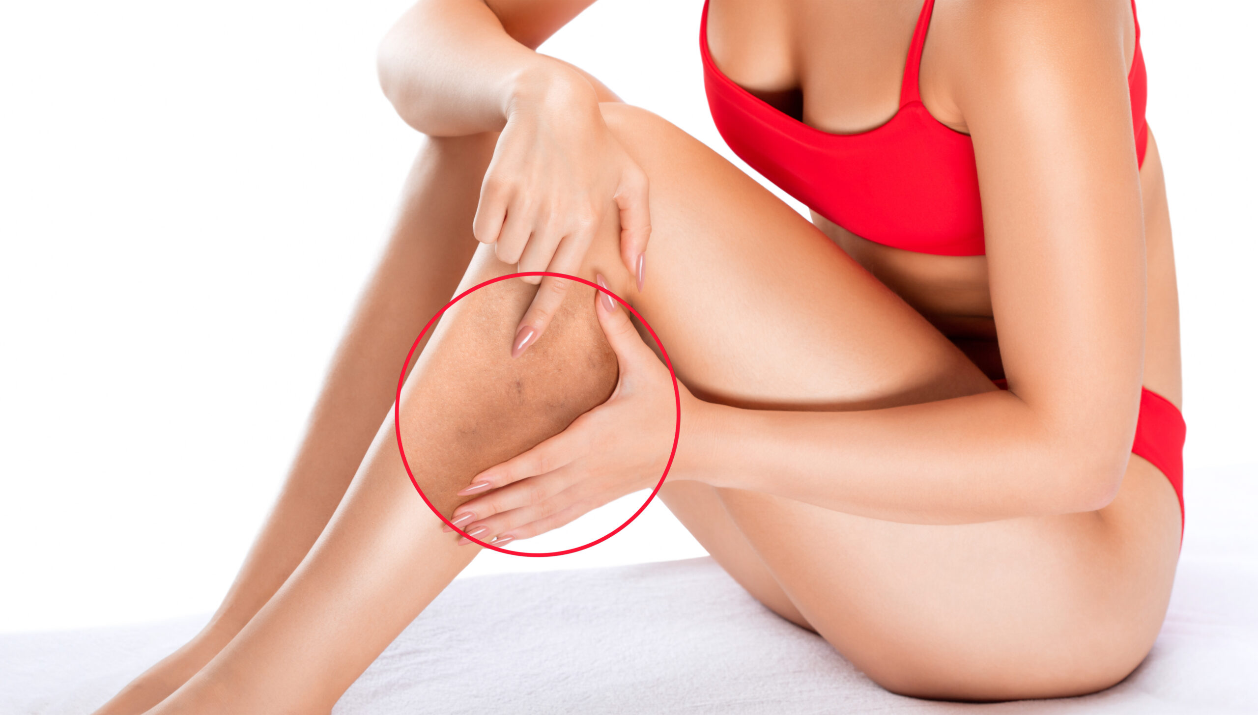 usuwanie żylaków metodą EVRF