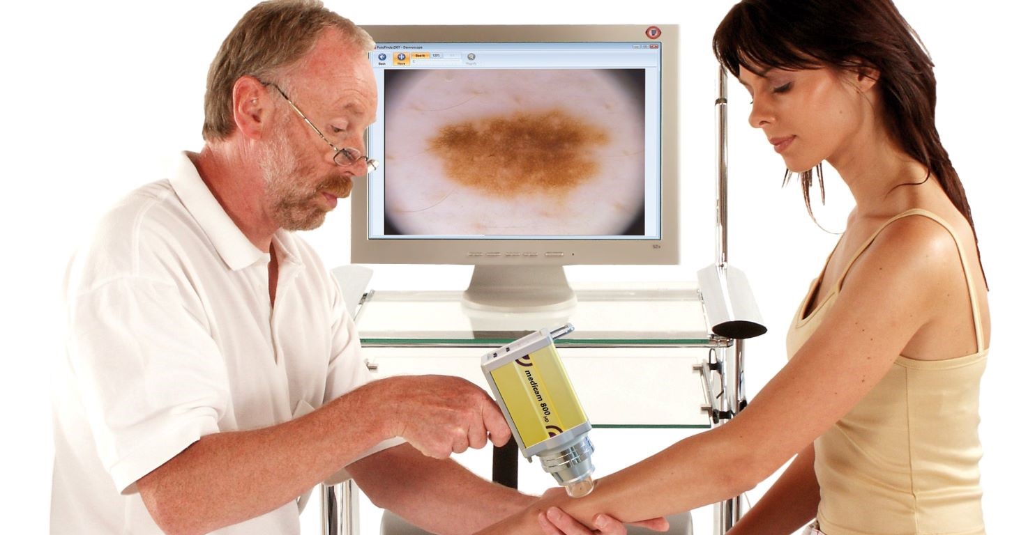 videodermatoskopia